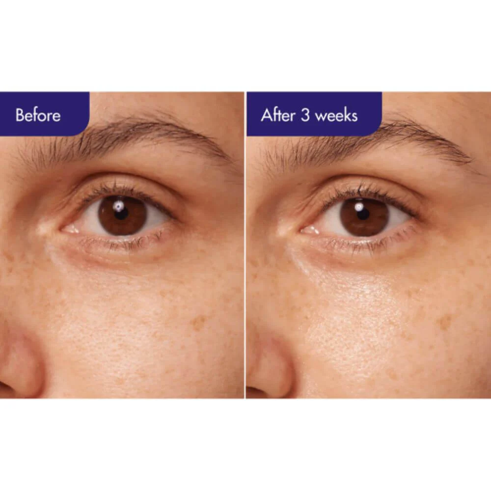 IOPE Retinol Expert 0.3% Wrinkle Corrector - Image 4