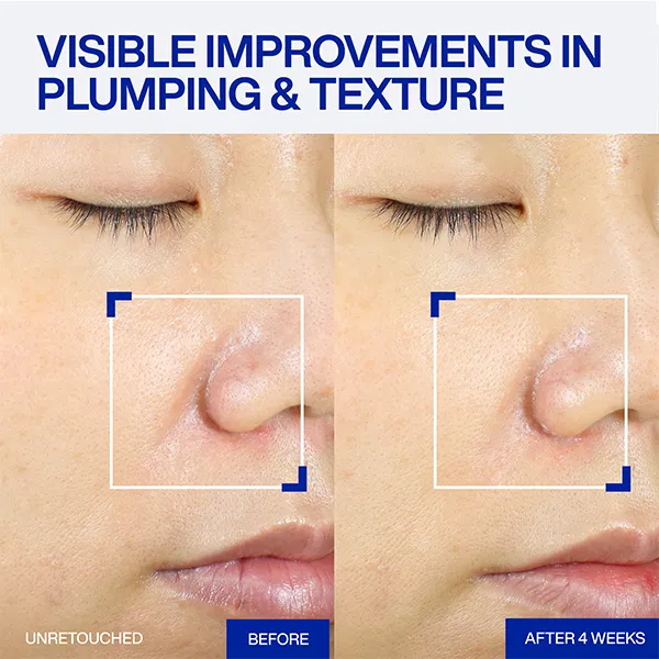 IOPE XMD Stem III Clinical Recovery Serum - Image 8